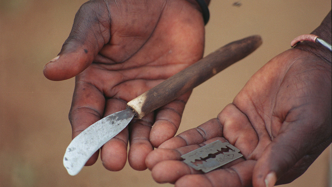 Female Genital Mutilation (FGM)