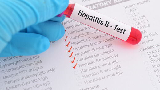 HIV, Aids and Hepatitis B